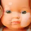 Doll with Vitiligo